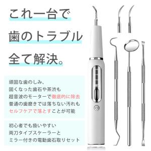 歯石取り 家庭用歯石取りセット 口腔洗浄器 超...の詳細画像3