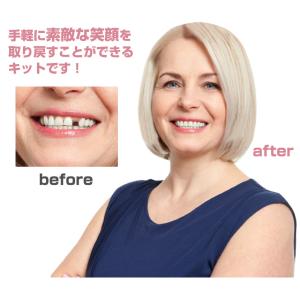 本物 正規品 インスタントスマイル テンポラリ...の詳細画像1