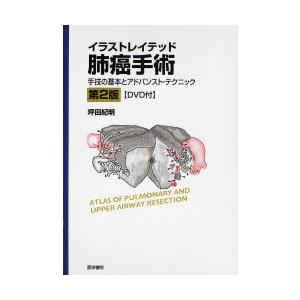 イラストレイテッド肺癌手術 手技の基本とアドバンスト・テクニック｜starclub