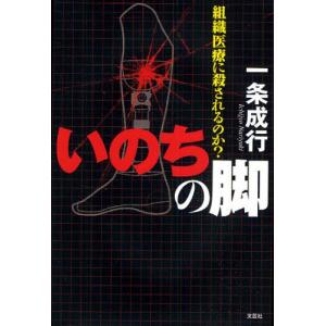 いのちの脚 組織医療に殺されるのか?｜starclub