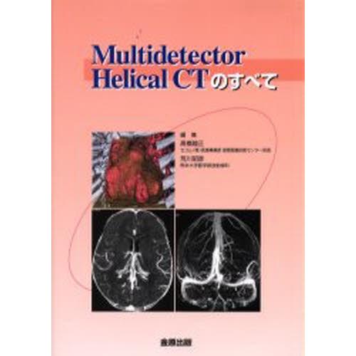 Multidetector Helical CTのすべて