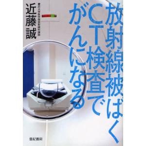 放射線被ばくCT検査でがんになる