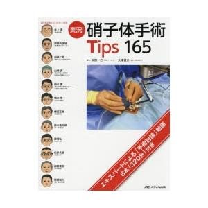 実況!硝子体手術Tips 165