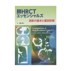 肺HRCTエッセンシャルズ 読影の基本と鑑別診断｜starclub