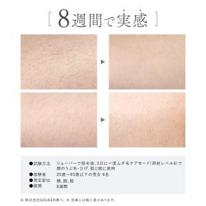 【2026NEWモデル】IPL&NIR...の詳細画像5
