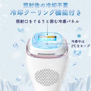 脱毛器 IPL 光脱毛器 冷却 ムダ毛処理 S...の詳細画像3