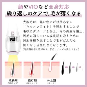 脱毛器 IPL 光脱毛器 冷却 ムダ毛処理 S...の詳細画像4