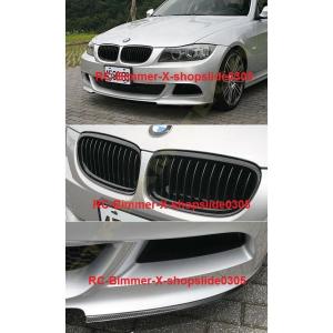BMW E92 E93 3シリーズ 前期用 リアルカーボン キドニーグリル