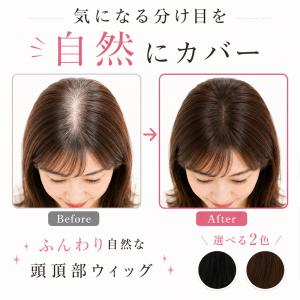 ヘアピース 部分ウィッグ 頭頂部ウィッグ ピン...の詳細画像2