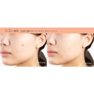 素肌シール 自然に隠す(傷あと・あざ隠し用シー...の詳細画像2
