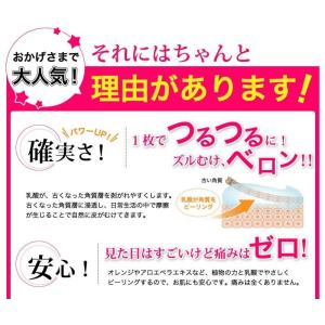 かかと 角質除去 両足4回分(ローズ・ベビーマ...の詳細画像1