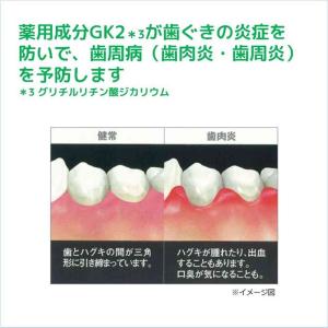 ガム・デンタルペースト155gの詳細画像1