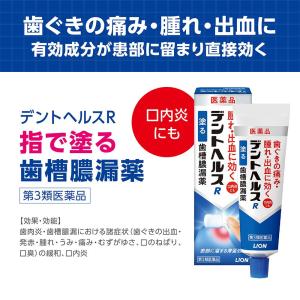 【第3類医薬品】デントヘルスR 40Gの詳細画像1
