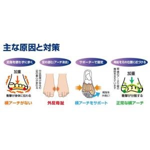 足指小町 歩行らくらくサポーター 内反小指 ソ...の詳細画像1