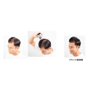 スーパーミリオンヘアー ダークブラウン 30gの詳細画像4