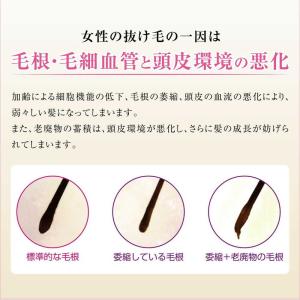 【医薬部外品】加美乃素本舗 薬用レディース加美...の詳細画像2