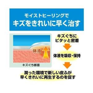 【ポイント5倍】【管理医療機器】ニチバン ケア...の詳細画像2