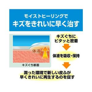 【ポイント5倍】【管理医療機器】ニチバン ケア...の詳細画像2