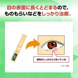 【第2類医薬品】ロート製薬ロート抗菌目薬I0....の詳細画像2