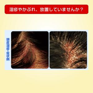 【指定第2類医薬品】メンソレータムメディクイッ...の詳細画像2