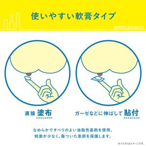 【指定第2類医薬品】ボラギノールA 軟膏 20gの詳細画像2