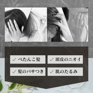 スカルプブラシ 頭皮 毛穴 皮脂汚れ スカルプ...の詳細画像3
