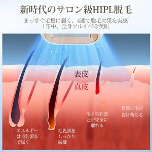 【クーポンで6980円!】脱毛器 vio対応 ...の詳細画像5