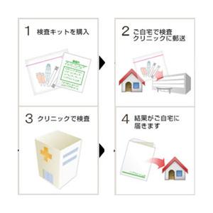 郵送検診 カンジダ検査 自宅検査 郵送検査キット