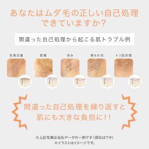 脱毛器 公式 TBC ヒカリビューティ 4 P...の詳細画像2