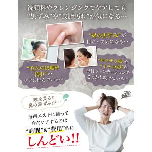【エステティシャン監修】 毛穴吸引器 毛穴ケア...の詳細画像4