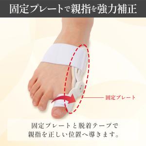 外反母趾 サポーター [理学療法士推薦] 足指...の詳細画像2