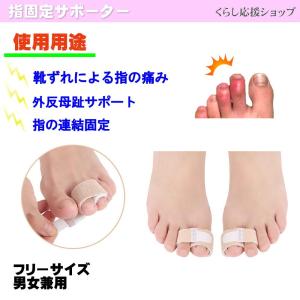 指サポーター 手 足 固定サポーター 2本指 ...の詳細画像1