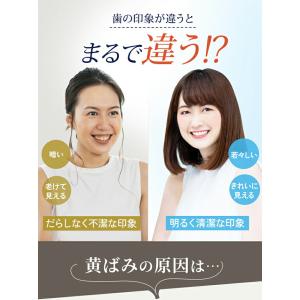 ホワイトニング歯磨き 歯が白くなる 歯磨き粉 ...の詳細画像4