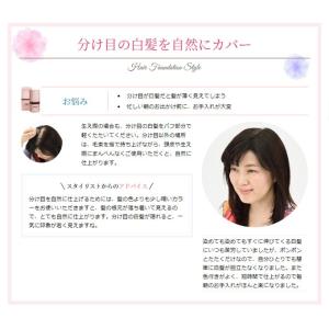 送料無料 最安値 スーパーミリオンヘアー SM...の詳細画像3