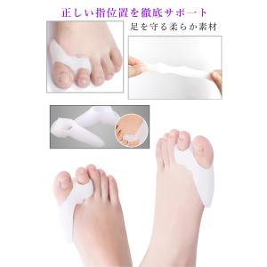 外反母趾 サポーター 足指サポーター 足指広げ...の詳細画像2
