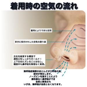 次世代ノーズピン!M+Lの2個入りセット いび...の詳細画像5
