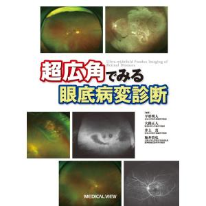 超広角でみる眼底病変診断−病巣を見逃さないために｜tomy-zone