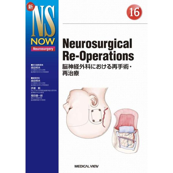 Neurosurgical Re-Operations−脳神経外科における再手術・再治療 (新NS ...