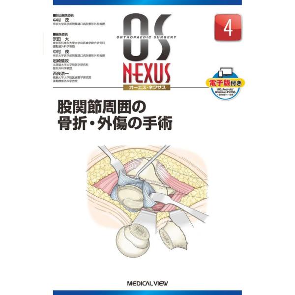 股関節周囲の骨折・外傷の手術 (OS NEXUS(電子版付き) 4)