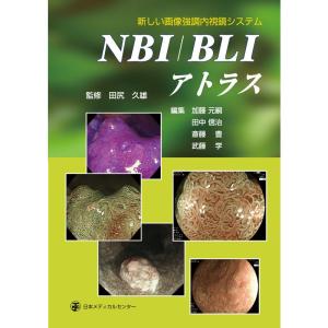 新しい画像強調内視鏡システム NBI /BLI アトラス｜tomy-zone