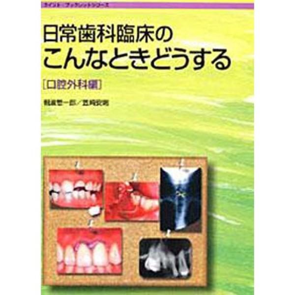日常歯科臨床のこんなときどうする 口腔外科編 (クイント・ブックレットシリーズ)