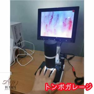 観察 血流スコープ◆毛細血管 顕微鏡880+6...の詳細画像3