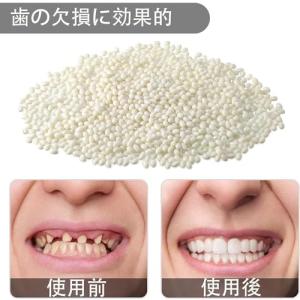 ShuaWdk 入れ歯、歯科用レジン、フィッテ...の詳細画像1