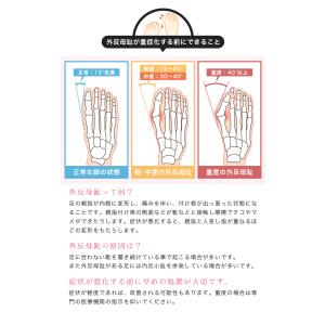 外反母趾 内反小趾 サポーター 親指 足指 シ...の詳細画像2