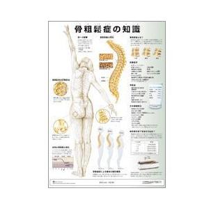 ミニポスター　骨粗鬆症の知識　51.5×36.4cm 医道の日本社