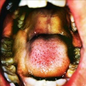 Hana Vu Public Storage＜Clear/White Marble Effect V...