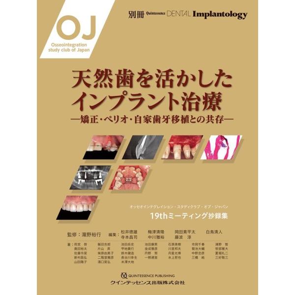 松井徳雄 天然歯を活かしたインプラント治療 矯正・ペリオ・自家歯牙移植との共存 Book