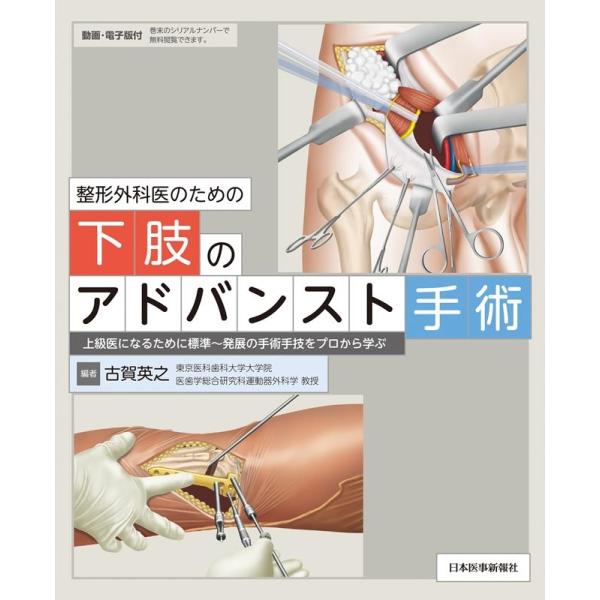 古賀英之 整形外科医のための下肢のアドバンスト手術 Book