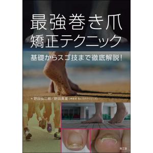 最強巻き爪矯正テクニック-基礎からスゴ技まで徹底解説! Book