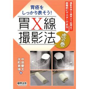 臨床・病理肺癌取扱い規約 第9版 : 有隣堂ヤフーショッピング店 - 通販